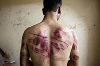 В сирийских тюрьмах применяют пытки